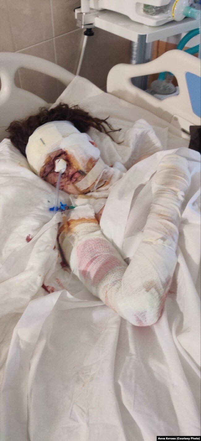 Анна Котова в лікарні після ракетного удару по Дніпру 14 січня 2023 року