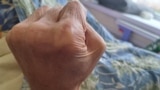 64-річний Віктор Мірошниченко мешкає в притулку для людей з інвалідністю у Дніпрі