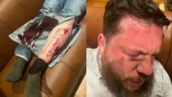 Lithuanian Police Hunt Suspect After Hammer Attack On Navalny Aide