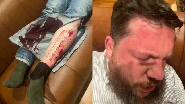 Lithuanian Police Hunt Suspect After Hammer Attack On Navalny Aide