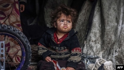 Lezbiyen uzun kokrak uchini soradi Nozik ayol onanizm bilan shugullanadi