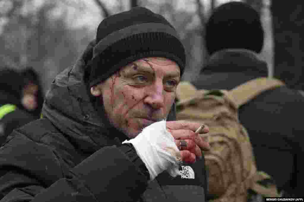 An injured man smokes a cigarette at the scene of the attack.