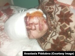 Ольга Гусак після удару по пологовому будинку у Маріуполі​