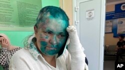 Elena Milașina este la un spital din Groznîi după ce a fost atacată de persoane mascate. Incidentul violent subliniază încălcările drepturilor omului în regiune.