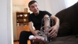 Қаңтар оқиғасы кезінде аяғынан оқ тиген алматылық Ділшат Әбдусаттаров. Алматы, 28 наурыз, 2023 жыл