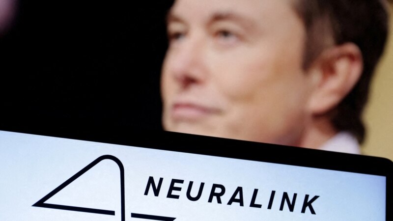 Илон Маск нейрочипҳои Neuralink-ро дар одамон месанҷад