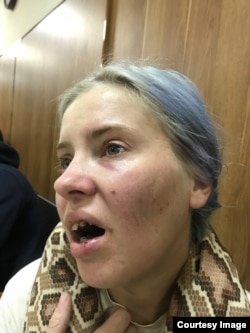 Инна Оленич после нападения на нее полицейского