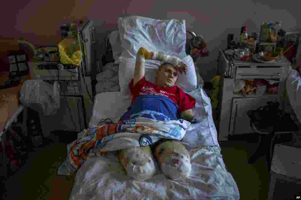 Anton Gladun (22) leži na krevetu u Trećoj gradskoj bolnici, u Čerkasima, Ukrajina, 5. svibnja 2022. Ovaj vojni medicinar koji je bio raspoređen na prvim linijama u istočnoj Ukrajini, izgubio je obje noge i lijevu ruku u mini eksplozija 27. ožujka. Fotograf AP-a Emilio Morenatti nagrađen je počasnim priznanjem u europskoj kategoriji natjecanja World Press Photo.