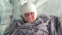 Ukrainian Boy With 80 Percent Burns Returns Home After More Than 30 Operations in Germany 