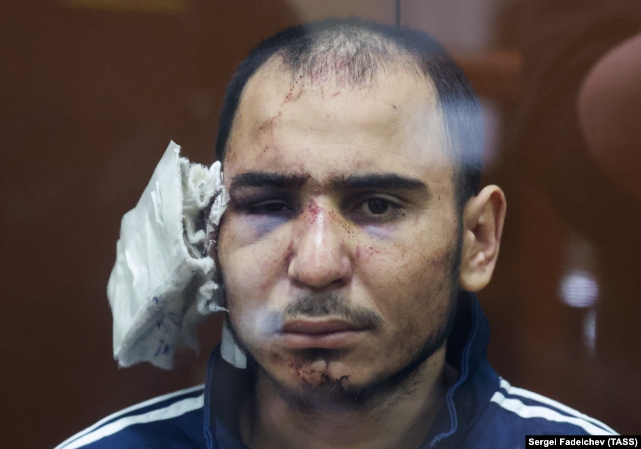 Rajabalizoda is seen at his March 24 court appearance with his right ear bandaged and showing evidence of being beaten while in detention.&nbsp;