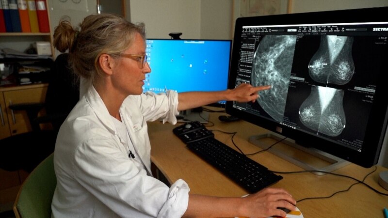 Umjetna inteligencija ubrzava otkrivanje raka dojke i Parkinsona