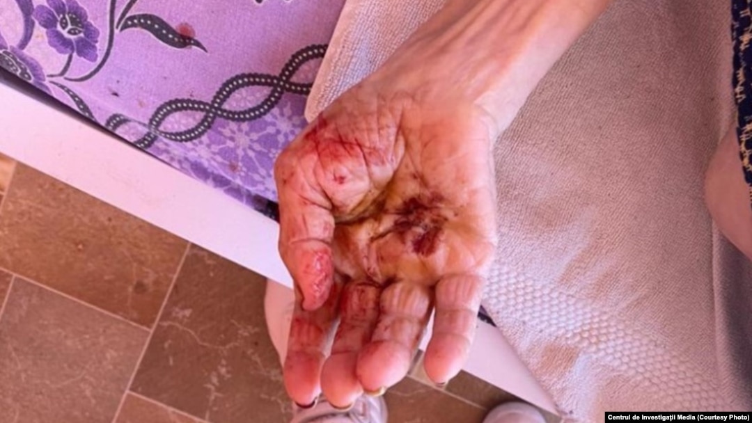 O frântură din coșmarul pe care îl trăiau bătrânii în căminele în care ar fi trebuit să fie îngrijiți, documentată de ancheta jurnalistică ce a dezvăluit de acum câteva luni ororile.