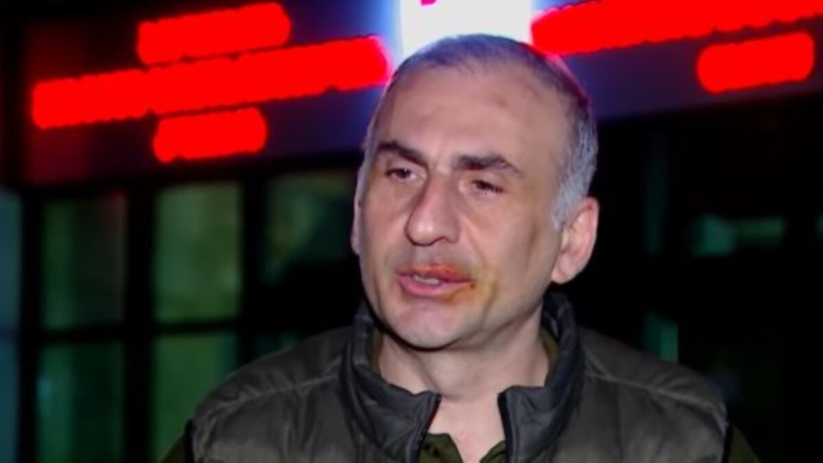 Элисашвили рассказал, что у него сломано ребро после задержания ...