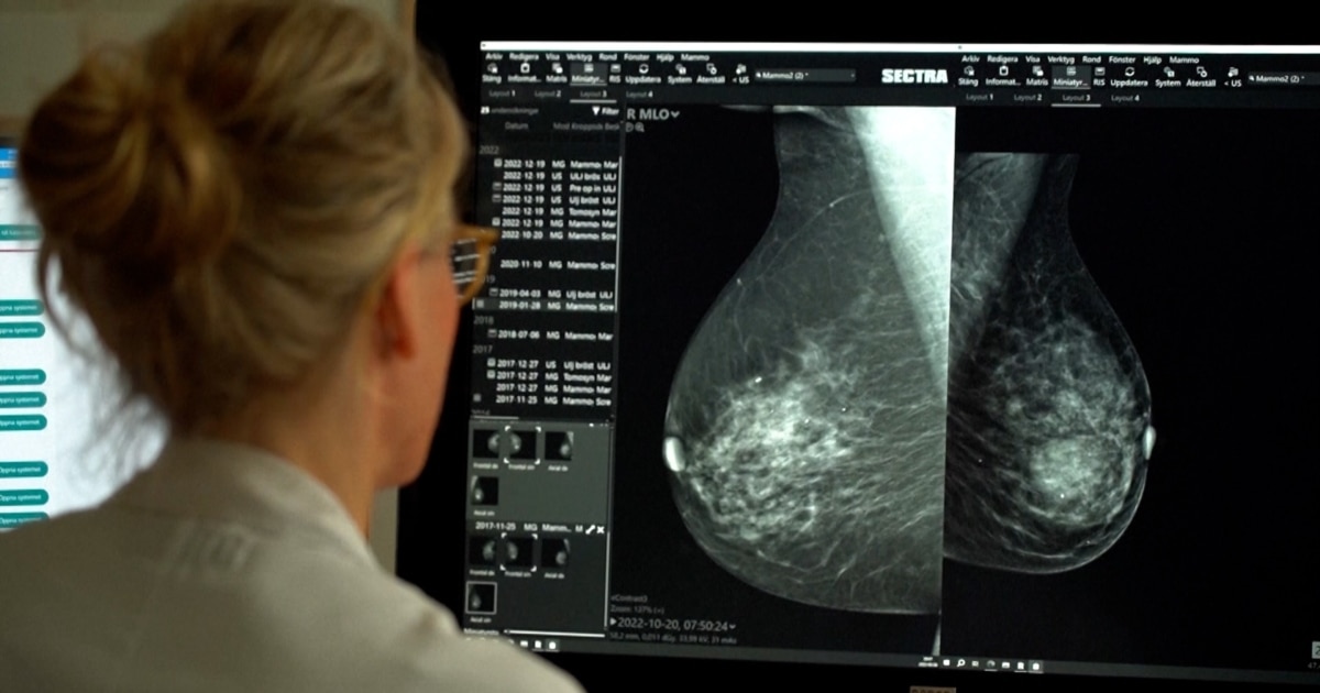 Mammolog tomonidan yashirin kamera tekshiruvi