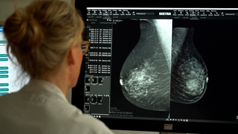 Mbi tre muaj pritje për një mamografi