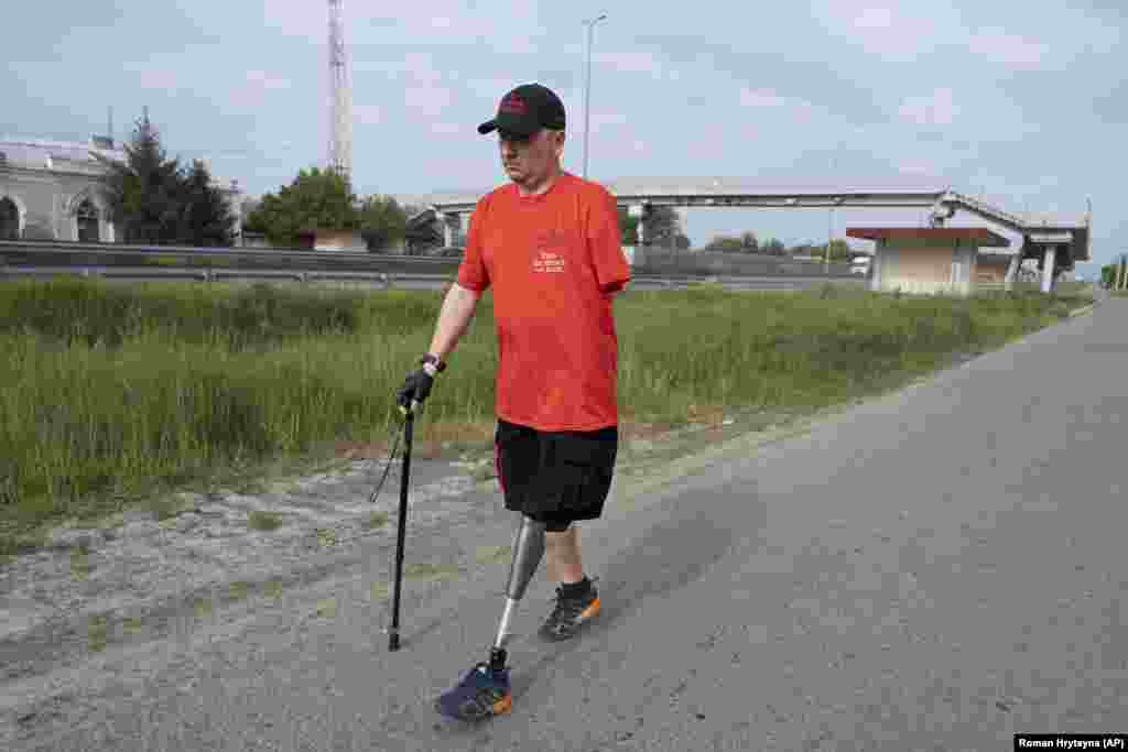 Из-за тяжёлых травм Сергею Храпко ампутировали руку и ногу. Он перенёс более 20 операций