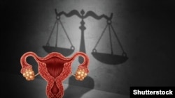 Женски репродуктивни права/Илустрација