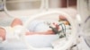 Koraszülött gyermek inkubátorban a Heim Pál Gyermekkórház Madarász Utcai Részlegének Koraszülött Osztályán 2019. november 15-én (képünk illusztráció)