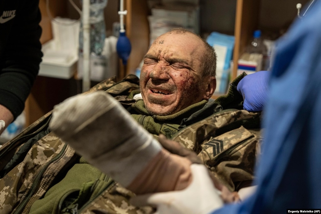Поранений український воїн на псевдо «Альфа» у польвому шпиталі. Бахмут, 26 лютого 2023 року