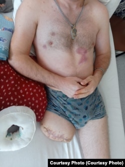 Павел Котиков в госпитале после ранения