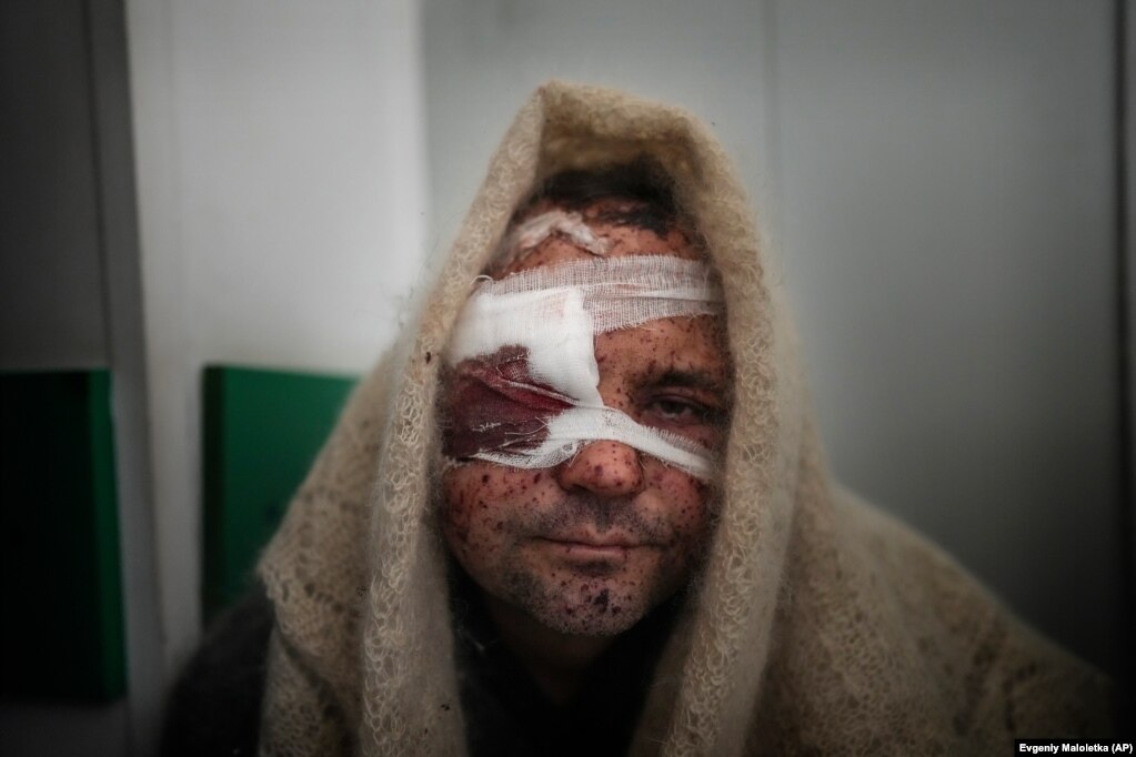 Serhiy Kralya, civil i plagosur gjatë bombardimeve të forcave ruse, pushon pas një operimi në spitalin e Mariupolit. 11 mars 2022. Evgeniy Maloletka, AP &nbsp; &nbsp;