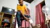 Anil Madusanka Ukraynada yaralanmış ayağını göstərir