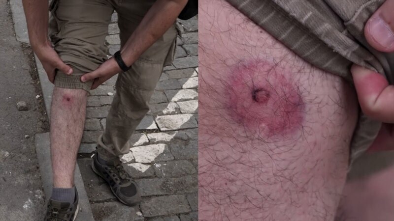 Gazetari i plagosur thotë se policia gjeorgjiane përdori plumba gome kundër protestuesve
