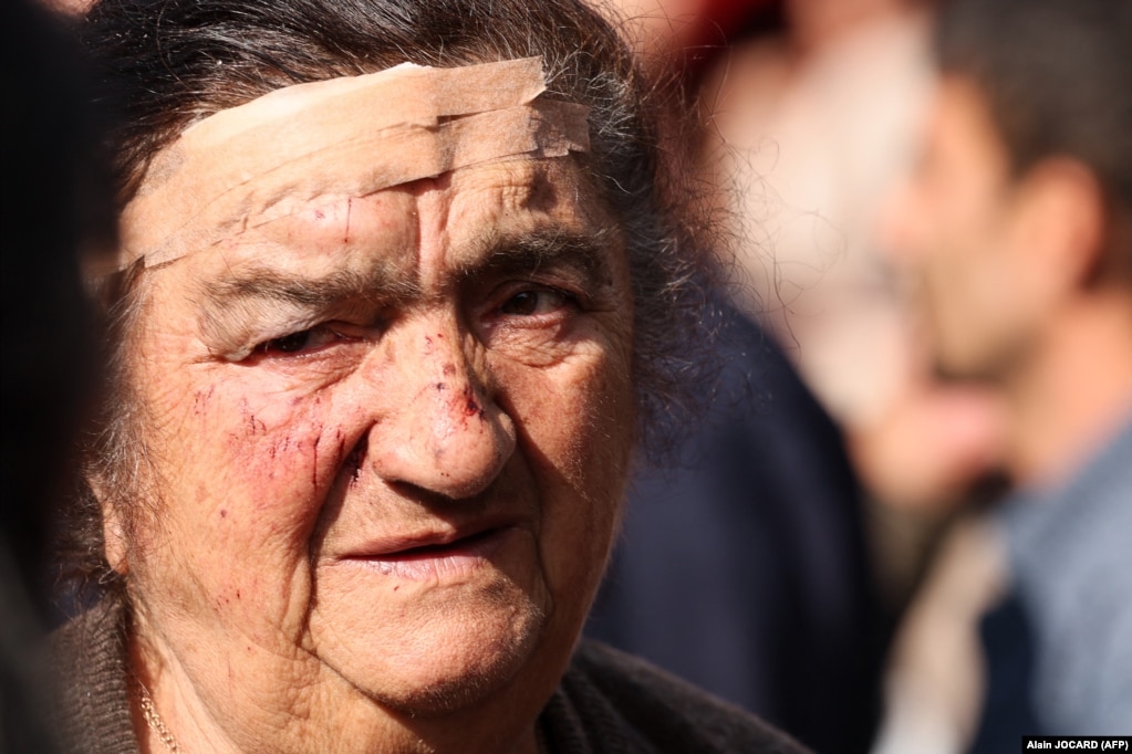 Një grua e moshuar, e lënduar në kokë, pret para një qendre për refugjatë në Goris më 27 shtator. Familja e saj u përfshi në një aksident trafiku në kohën kur po iknin nga Nagorno-Karabaku. Në total, 192 trupa azerbajxhanase u vranë dhe 511 të tjerë u plagosën gjatë ofensivës së javës së kaluar, njoftoi Ministria e Shëndetësisë së Azerbajxhanit më 27 shtator.