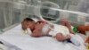 Sürgősségi császármetszéssel hoztak világra egy kislányt április 20-án éjjel Rafahban, miután édesanyját&nbsp;férjével és lányával együtt megölték egy izraeli támadásban. <em>&bdquo;A 1,4 kg súlyú baba állapota stabil és fokozatosan javul&rdquo;</em> &ndash; jelentette ki Mohammed Szalama, a csecsemőt ápoló orvos. A baba édesanyja, Szabrin al-Szakani harminchetes terhes volt, családjával aludt, amikor a támadás történt