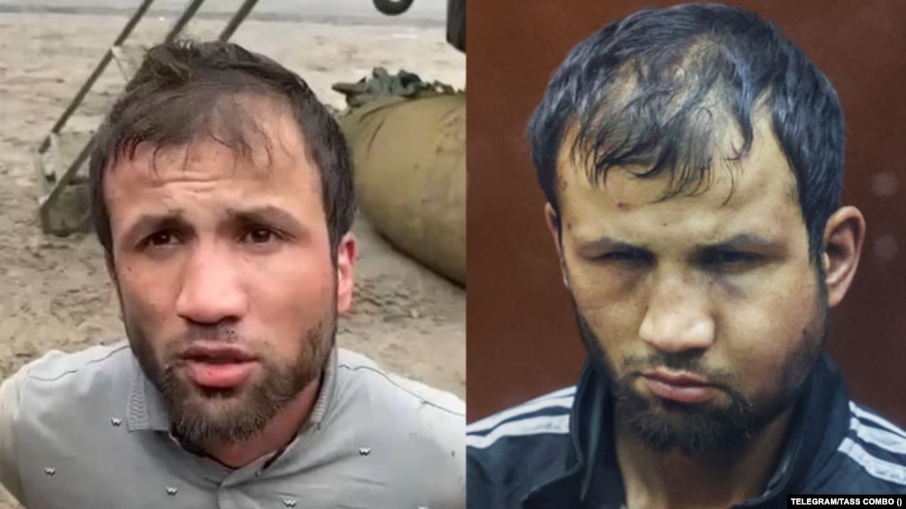 Before-And-After Images Suggest Severe Abuse Of Moscow Terror Suspects