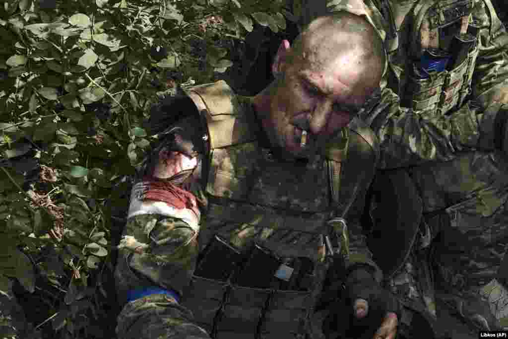 An injured Ukrainian soldier smokes a cigarette.