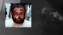 Violent Attacks Leave Opponents Of Georgian 'Foreign Agent' Bill Bloodied, Bruised, And Defiant 