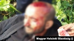 Kurram Sahzed, miután a magyar rendőrök kivitték a határ melletti senkiföldjére, leültették és összeverték, 2016. augusztus 12-én