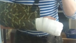 Сломанная рука Игоря, военнослужащего из Забайкалья, не получившего выплаты