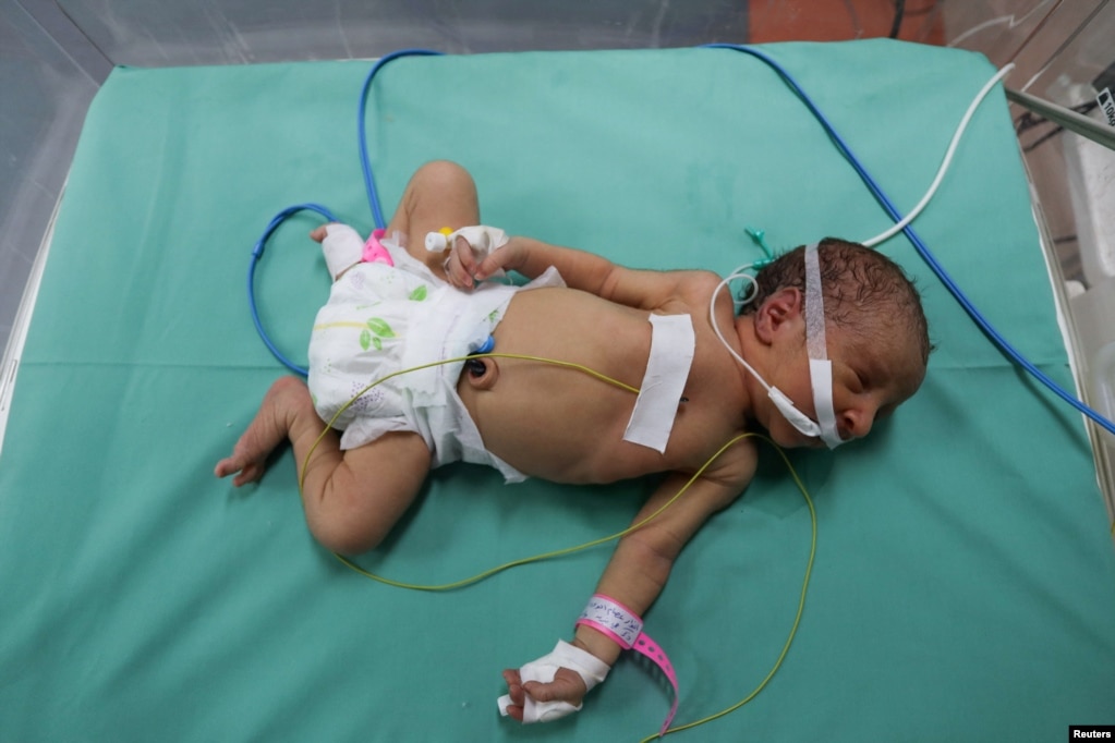 Një foshnjë palestineze e lindur parakohe e vendosur në një inkubator në repartin e maternitetit të spitalit Shifa, i cili sipas zyrtarëve shëndetësorë, është në prag të mbylljes pasi po i mbaron karburanti dhe nga mungesa e energjisë elektrike në Gaz.