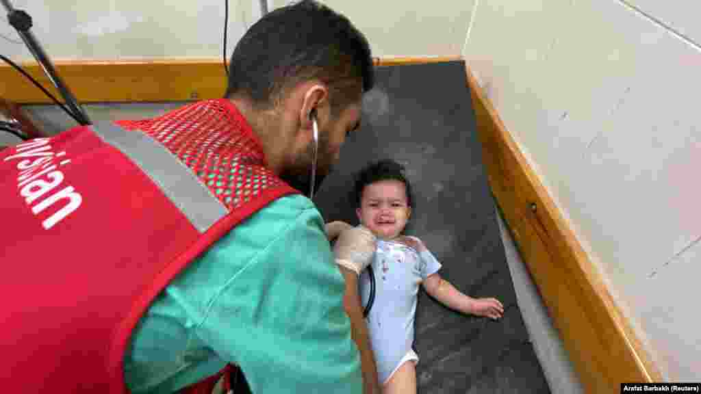 Një foshnje palestineze e plagosur në sulmet izraelite duke u trajtuar në një spital në Khan Younis, Rripi i Gazës m 14 tetor 2023.