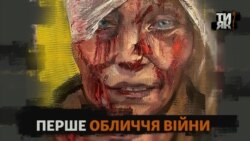 «Господи, я ще не хочу вмирати»: як змінилося життя українки з перших шпальт світових медіа (відео)