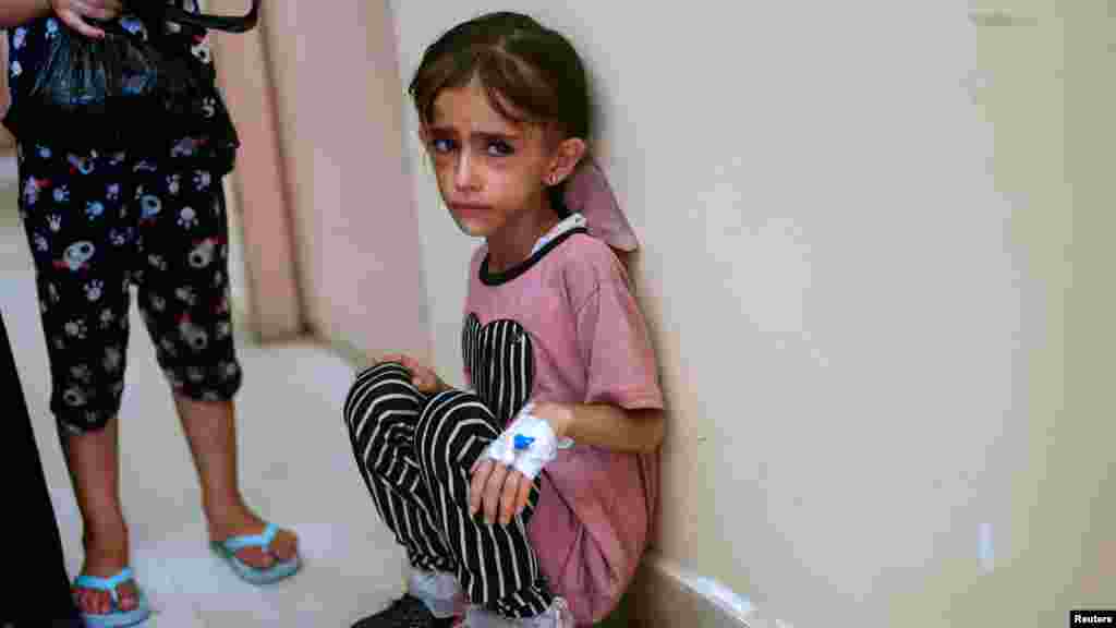 Egy rákbeteg és alultáplált palesztin kislány, a hán júniszi&nbsp;Nasszer kórházban várja, hogy a Gázai övezeten kívülre szállítsák kezelsére. A felvétel&nbsp;2024. június 24-én készült.&nbsp; Az ENSZ gyermekvédelmi szervezete, az UNICEF szerint minden harmadik gyermek akut alultápláltságban szenved a Gázai övezetben
