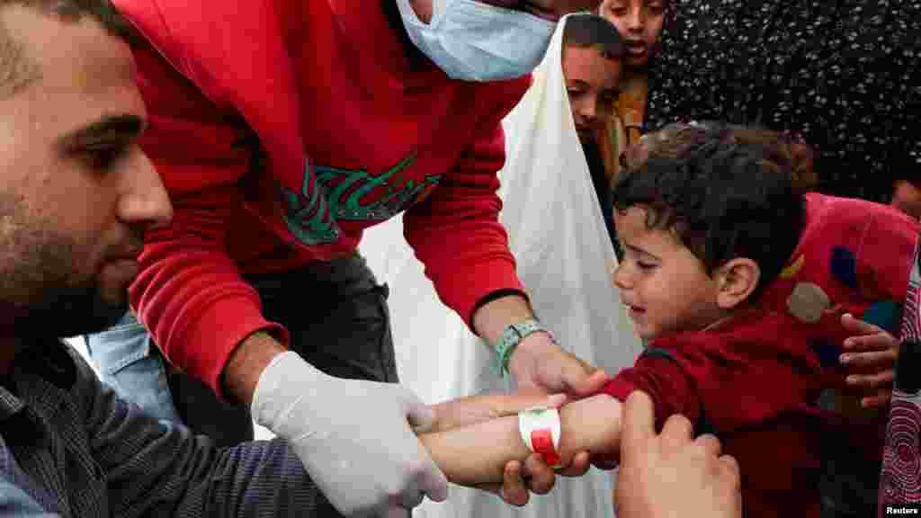 Timovi ljekara iz MedGlobala i UNICEF-a vrše mjerenja na ruci palestinskog dječaka koji pati od pothranjenosti, Rafa, 14. februar 2024.