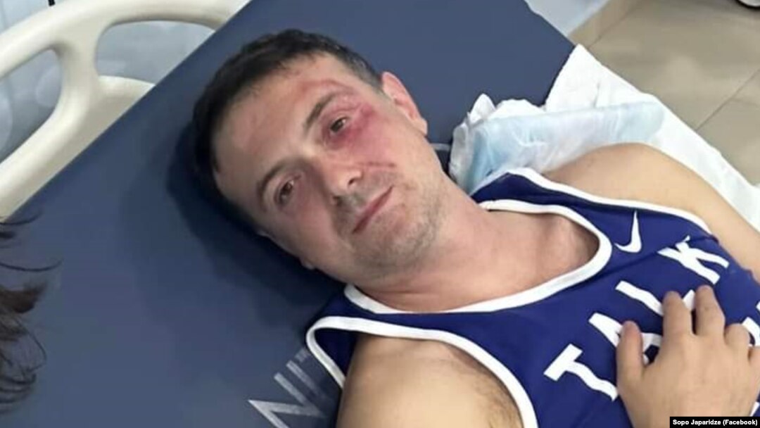ირაკლი ეძგვერაძე, თბილისის საკრებულოს ფრაქცია „ერთიანი ნაციონალური მოძრაობის" წევრი. 