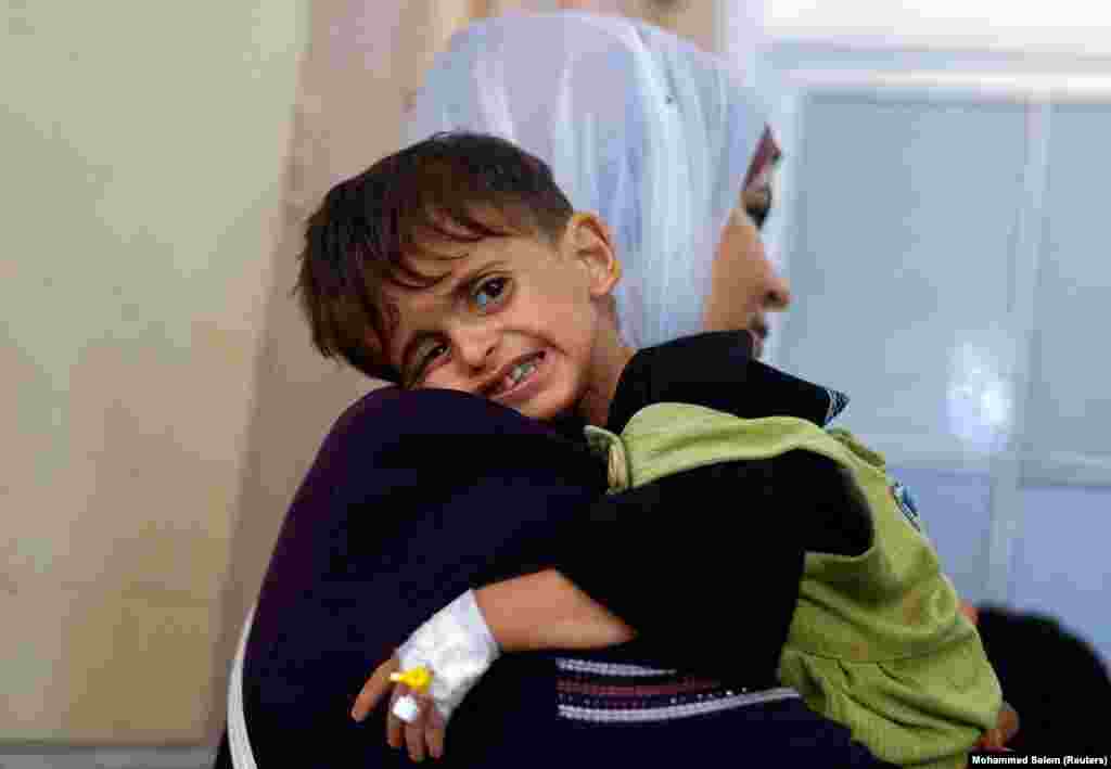 Nada, një grua palestineze, mban në krahë djalin e saj të vogël, Amjad Al-Kanoo, i cili vuan nga kequshqyerja. Amjad që po trajtohet në spitalin Nasser në Han Junis, është&nbsp;në pritje për t&#39;u transferuar për trajtim jashtë Gazës, 24 qershor 2024.