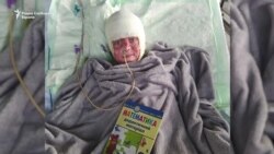 Украинско момче со 80% изгореници се врати дома по повеќе од 30 операции во Германија