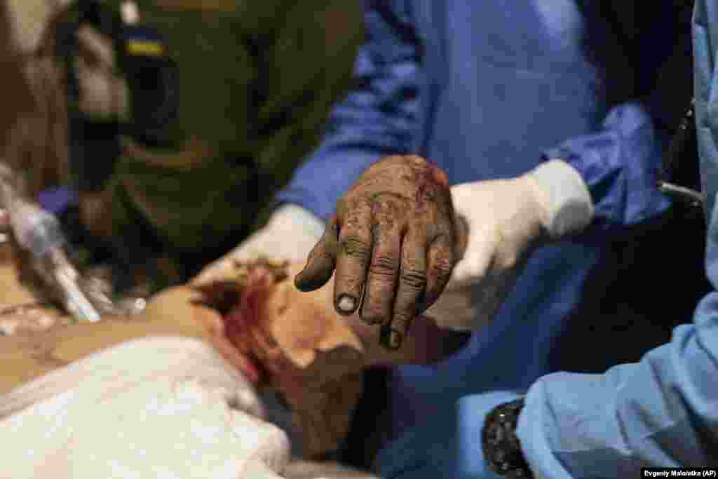 Medical staff hold the arm of a soldier during treatment of his wounds. According to the Ukrainian authorities, Russian troops conducted 81 offensive operations against Ukraine over the 24 hours leading up to February 27. They say Russian forces targeted Bakhmut, Avdiyivka, and Shaktarsk in the Donetsk region and Kupyansk in Ukraine&#39;s Kharkhiv region.