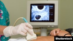 Hamilə qadının ultrasəs diaqnostikası