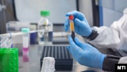 Virológiai vizsgálati minták a PTE Szentágothai János Kutatóközpontjának laboratóriumában 2023. február 7-én