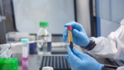 Virológiai vizsgálati minták a PTE Szentágothai János Kutatóközpontjának laboratóriumában 2023. február 7-én