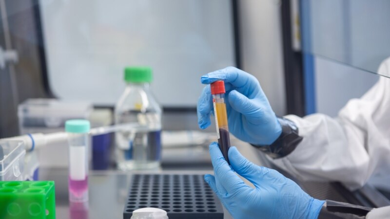 Magyar kutatók rájöttek, milyen szerepet játszanak az agy immunsejtjei a Covid idegrendszeri tüneteiben