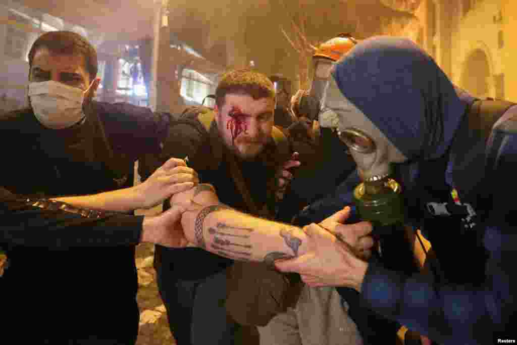 Protestuesit ndihmojnë një të plagosur gjatë një tubimi në Tbilisi. Sipas Ministrisë së Shëndetësisë të Gjeorgjisë, të paktën 11 persona, përfshirë gjashtë oficerë policie, janë trajtuar në spital pasi ishin plagosur.