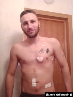 Добраахвотнік Дзяніс Урбановіч у шпіталі пасьля раненьня. Архіўнае фота