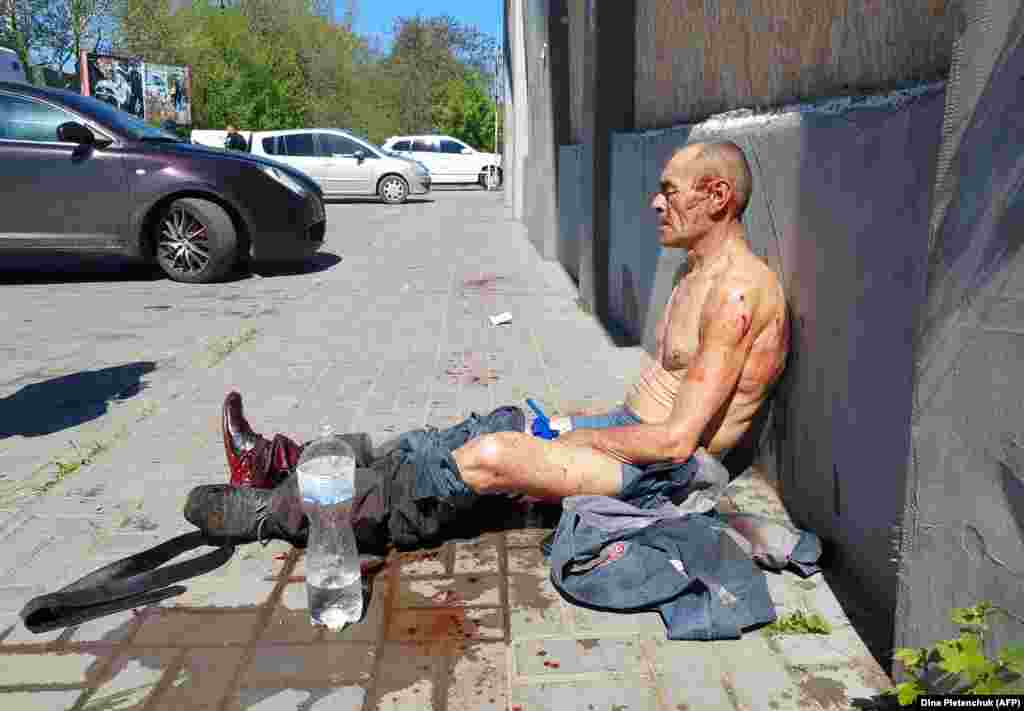A wounded man sits outside of a local shopping center following a Russian military strike.